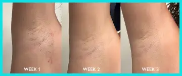 Tend Skin Solution