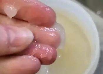 tlexure