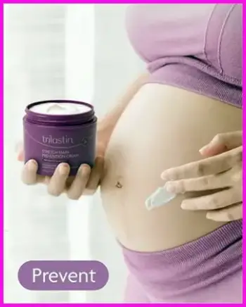 Trilastin Stretch Mark Cream