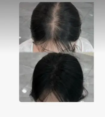 Snidin Hair Growth Spray