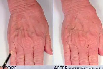 Nassifmd Hydro-Screen Serum 