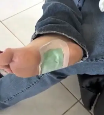 Bandoo Foot Pads 