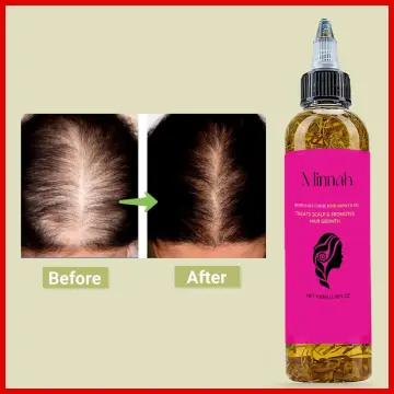 Minnah Crack Hair Oil