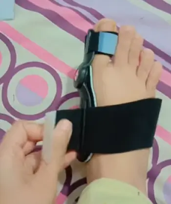 Recovist Bunion Brace