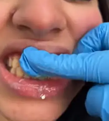 Utogru Whitening Toothpaste 
