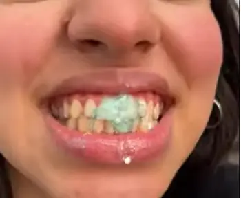 Utogru Whitening Toothpaste 