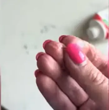Alocane Burn Gel