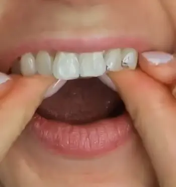 Brookstone Whitening Strips 