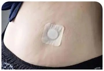 Rejuvacare Lean Patch