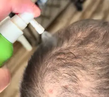 Svvimer Hair Growth Spray