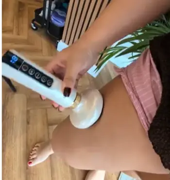 SHE Vitality Cellulite Massager
