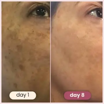 Eveloria Turmeric Pads 