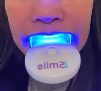 SmilePro Teeth Whitening Kit