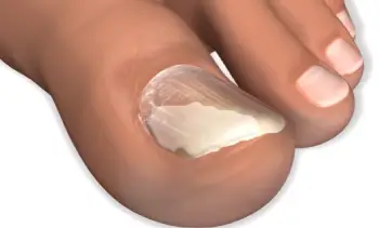 NONYX Nail Gel