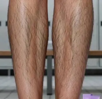 Auures Hair Removal