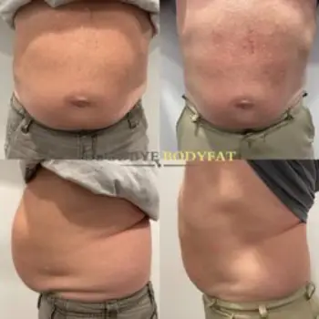 SlimFierce Weight Loss 