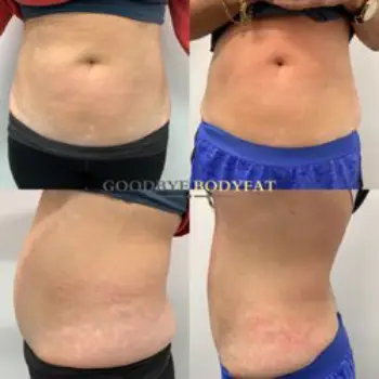 SlimFierce Weight Loss 